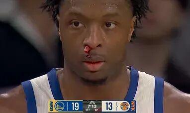 勇士伤病潮下硬刚尼克斯 科尔力挺缩短赛程引热